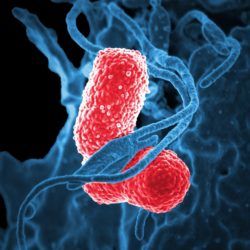 What Are The Common Bacteria That Cause Pneumonia?