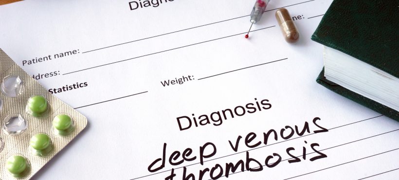 Everything You Wanted to Know about Deep Vein Thrombosis (DVT)