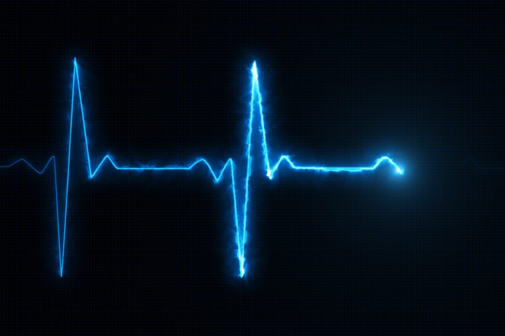 Cardiogram cardiograph