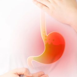 GERD (Acid Reflux): Causes, Symptoms, Diagnose, Treatment